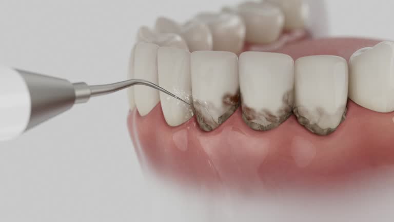 Reliable Dental Implants contractor in Lompoc, CA by Smile Center Dentistry